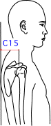 C集合図12