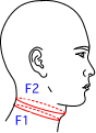 F集合図1