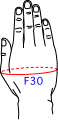 F集合図3