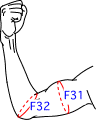 F集合図4