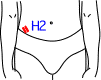 H集合図2