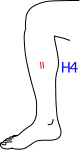 H集合図3