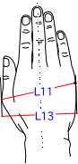L集合図3