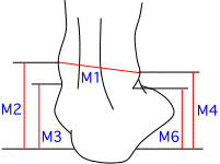 M集合図1