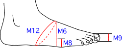 M集合図3
